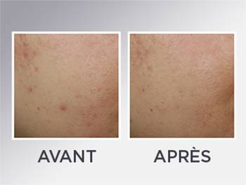 2991 GAR DIGITAL MAJ ASSET AIR CREAM SITE GARNIER V1 390x294px 02