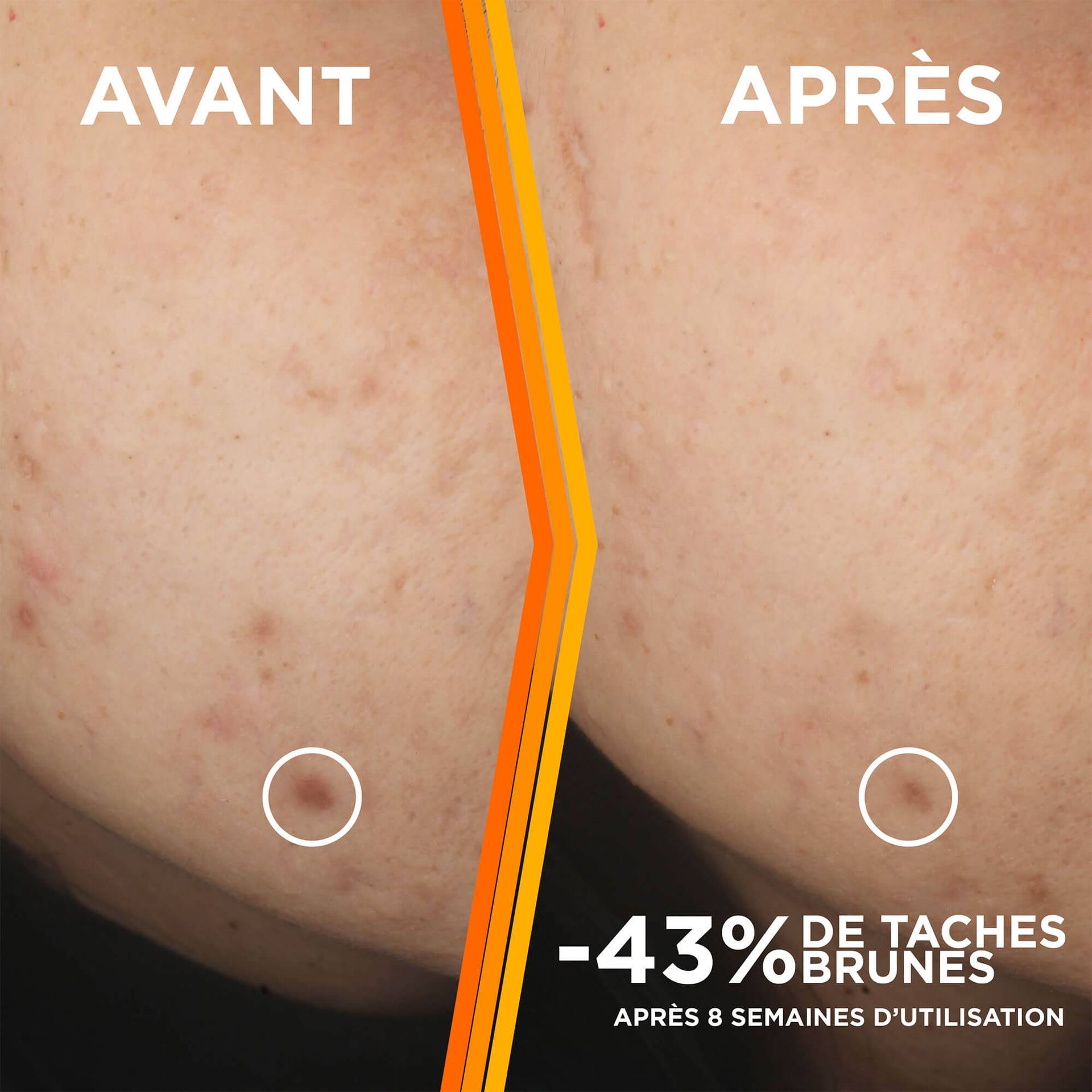 9686 GAR VitC BEFORE AFTER PSD VFINAL